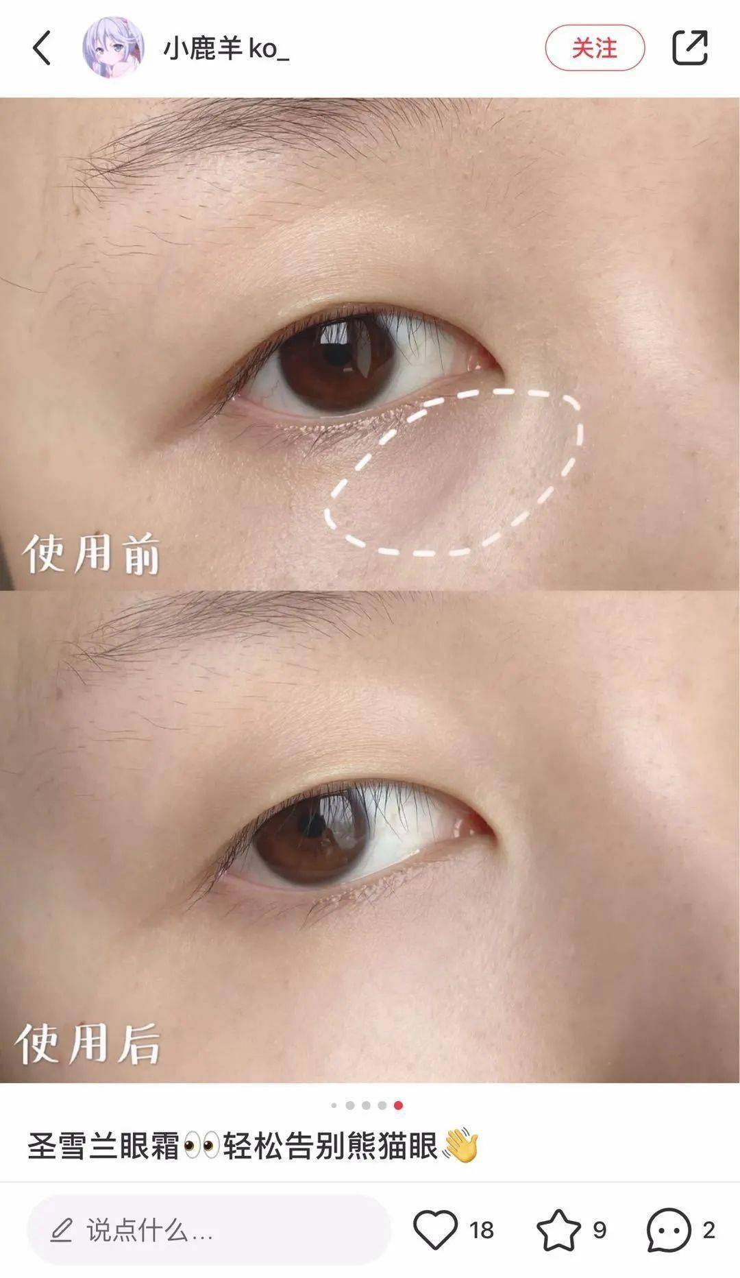 黑眼圈|实名推荐这款国货眼霜,99元去掉20年的熊猫眼,还不长脂肪粒!