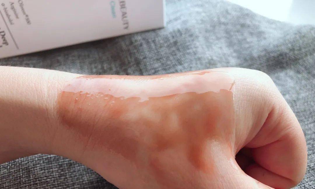 张天|长期闭口、粉刺、痘痘满脸的人，微镜头下毛孔竟然是这样的！赶紧get林允、张天爱的0毛孔秘籍吧！