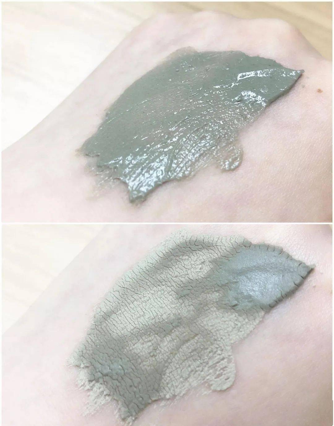 张天|长期闭口、粉刺、痘痘满脸的人，微镜头下毛孔竟然是这样的！赶紧get林允、张天爱的0毛孔秘籍吧！