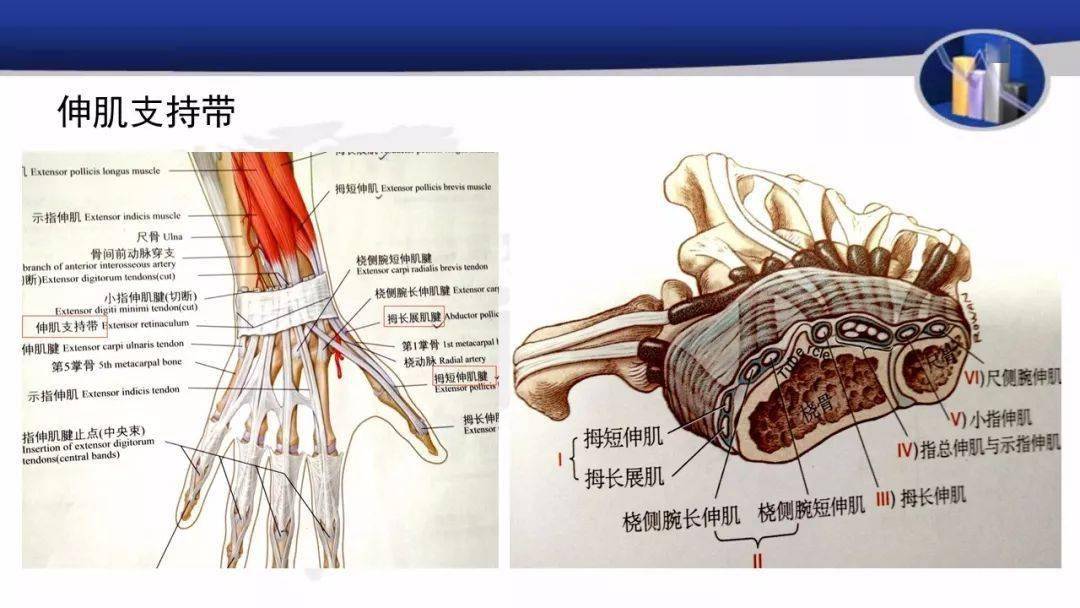 桡骨茎突狭窄性腱鞘炎