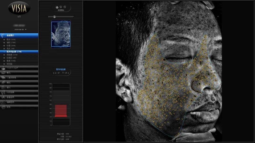 多人实测丨用了一下,斑就"没"了,有这么神?_斑点