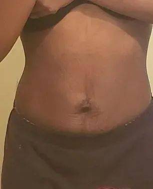 小时|妹子狂瘦40公斤仍不满足，每天勒18小时束腰，想成为腰最细的人…