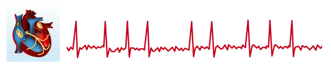 疫情|【卫生社团】新冠疫情期间，房颤患者如何做好自我管理？