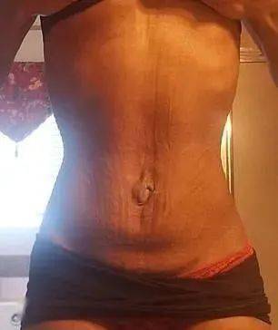 小时|妹子狂瘦40公斤仍不满足，每天勒18小时束腰，想成为腰最细的人…