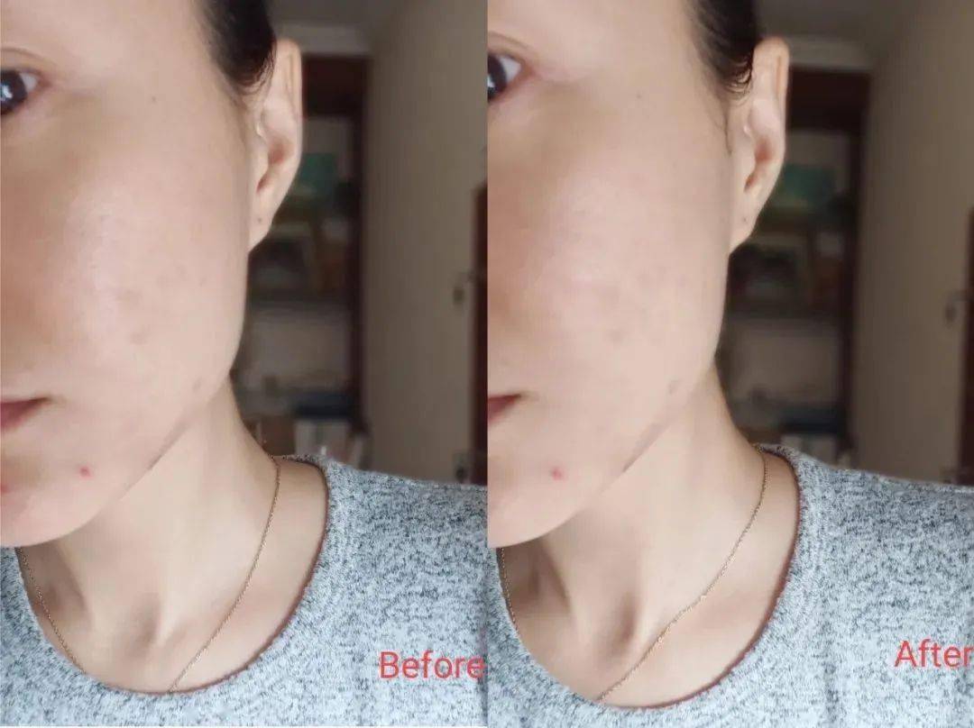 Bug|寻芳记｜换季肤况出Bug？听说比奶茶还甜的她们都用这招！