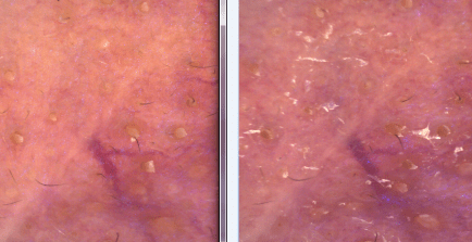 泡沫|能卸妆能洁面，Elta Md洗面奶