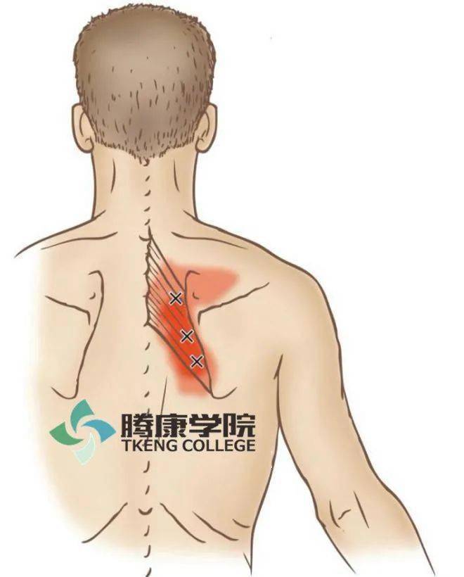 肩关节疼痛的相关肌肉