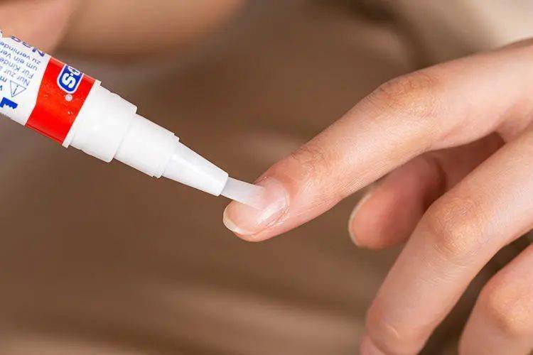 真菌|用“笔”刷一刷，灰指甲竟慢慢变光亮了