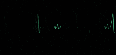 759fac689ded41c8a443875a530dca70.gif
