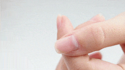 真菌|用“笔”刷一刷，灰指甲竟慢慢变光亮了