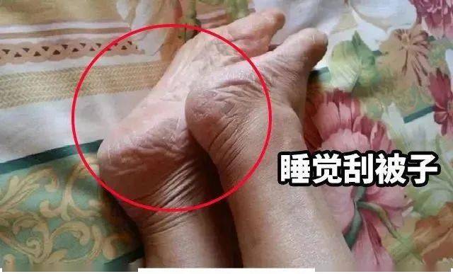 拖鞋|爱穿凉鞋、拖鞋出门的女人,脚上露出这个东西也太丑了吧~