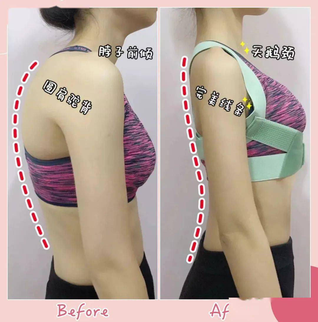 矫姿|好体态，胜过好容颜丨好物