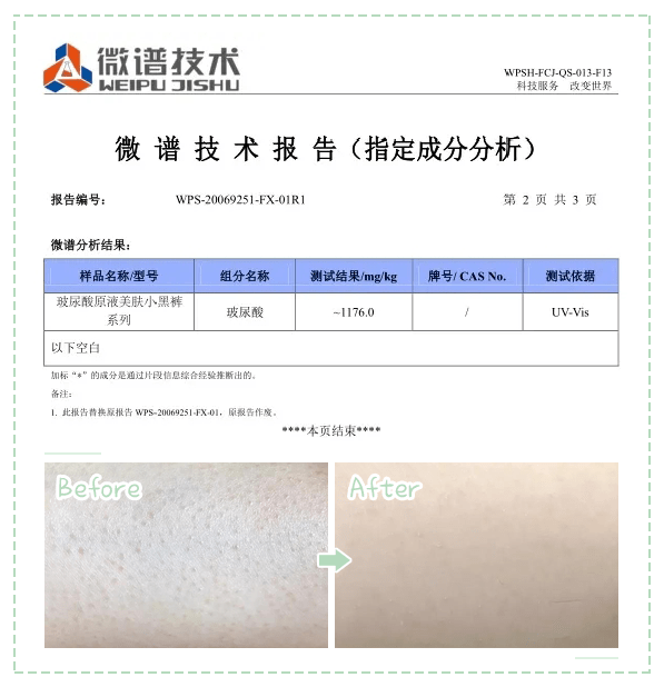 筒裤|比阔腿直筒裤还显瘦显高的小黑裤，上身显瘦10斤腿长5厘米，千万别试！