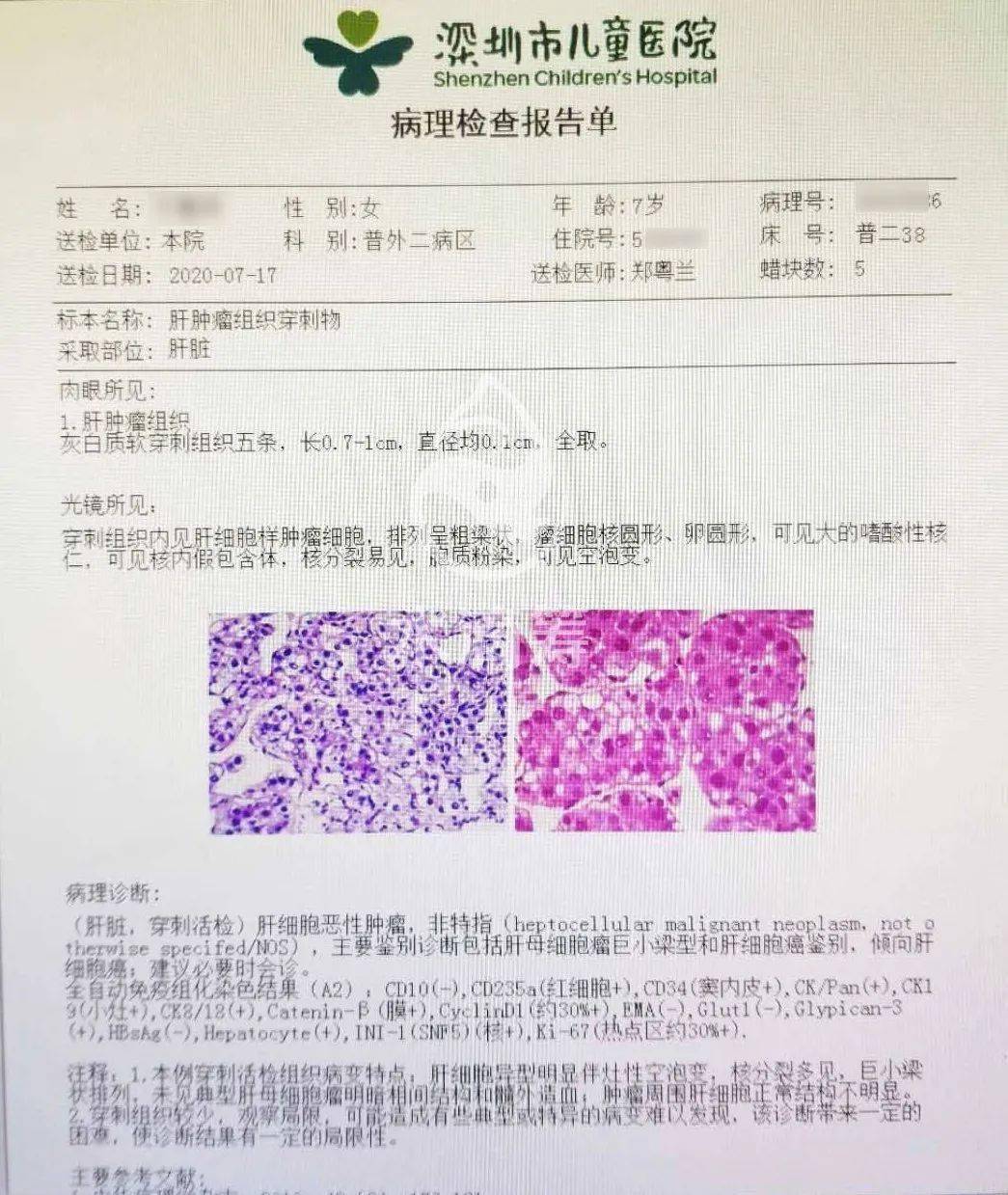 症状|一查已是肝癌晚期，孩子出现以下症状，家长一定要重视！7岁女孩肚子疼