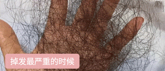 头发|头皮发痒，出油，还掉发？原来是你的洗发水没选好...