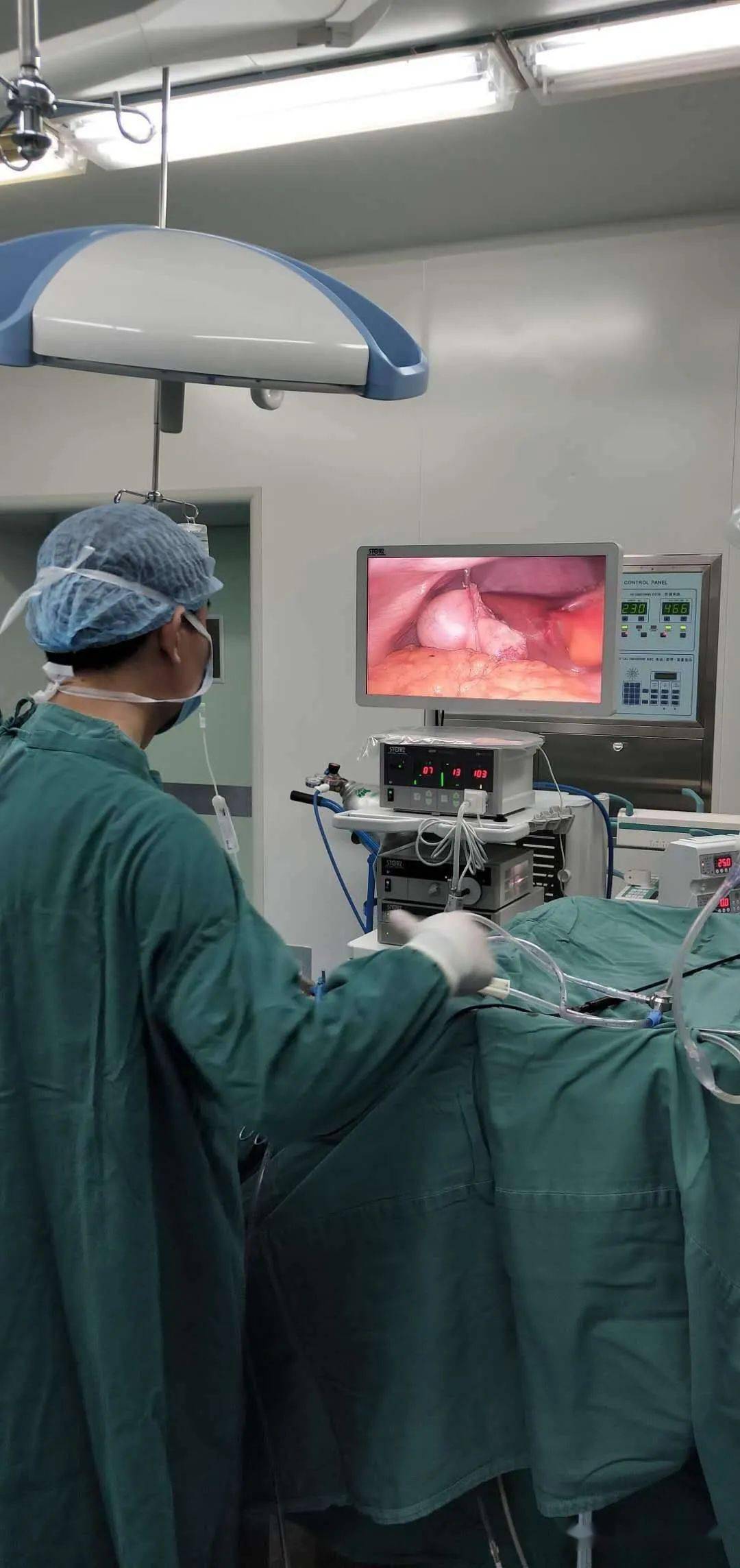 中医院我院成功为一例体重达106公斤的肥胖患者实施腹腔镜胆囊切除术