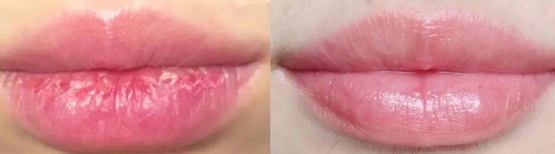 嘴唇|那些懂得珍爱自己的女孩儿，过得比较开心