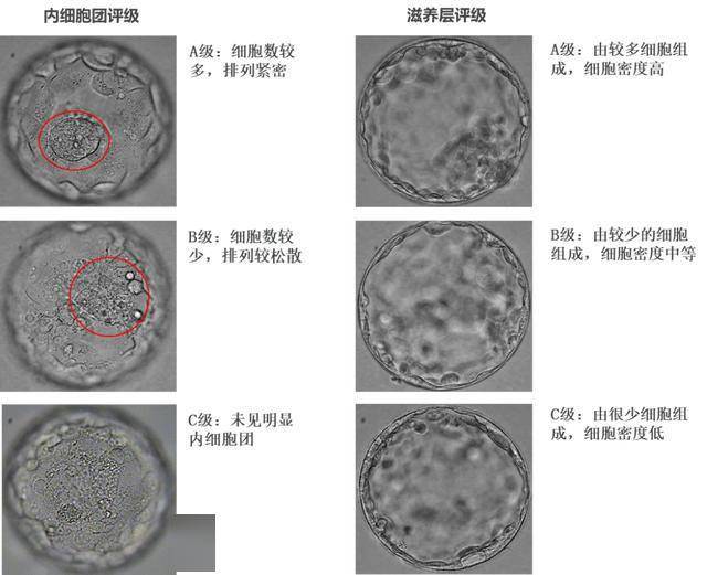 一般来说会优先移植扩张度,内细胞团和滋养层评级高的囊胚.