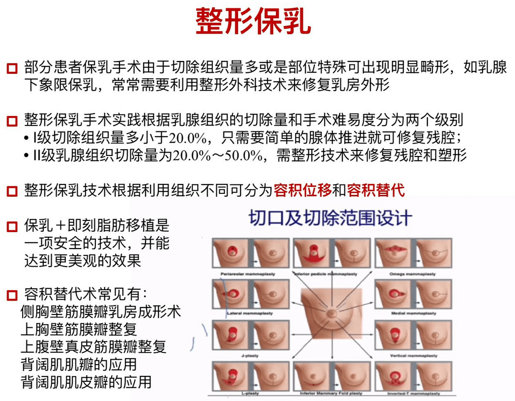 叶松青教授:乳腺癌外科进展——保乳手术