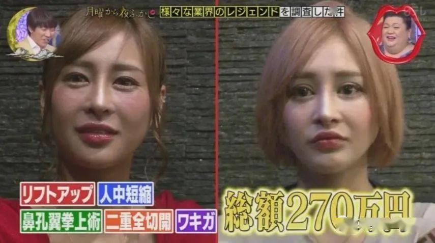 妹子|霓虹妹子整容上百次＂走上人生巅峰＂，以后还想整成桥本环奈…