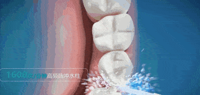 口腔|专业牙医也在用的冲牙器，1秒滋出牙缝残渣，爽！
