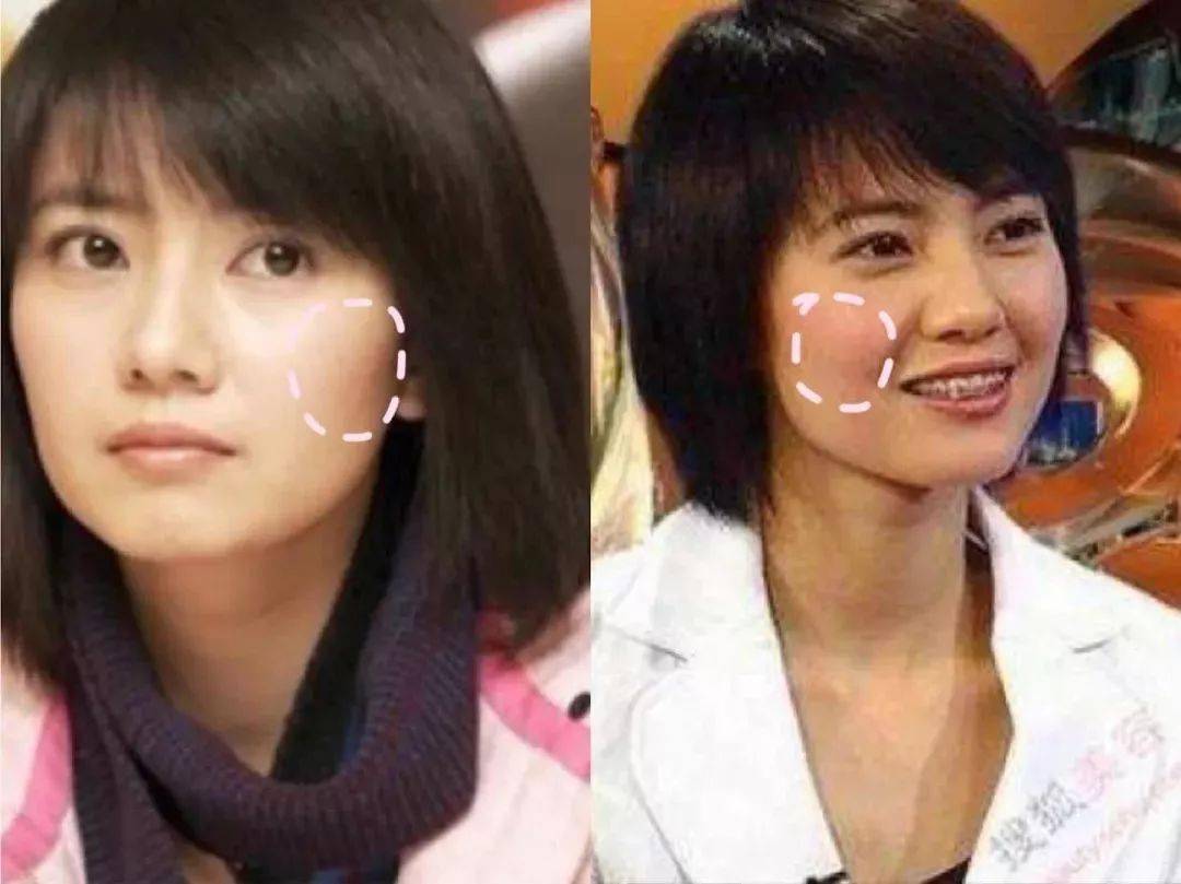 鹅蛋脸|肉脸还是大脸?选对发型你就是鹅蛋脸!