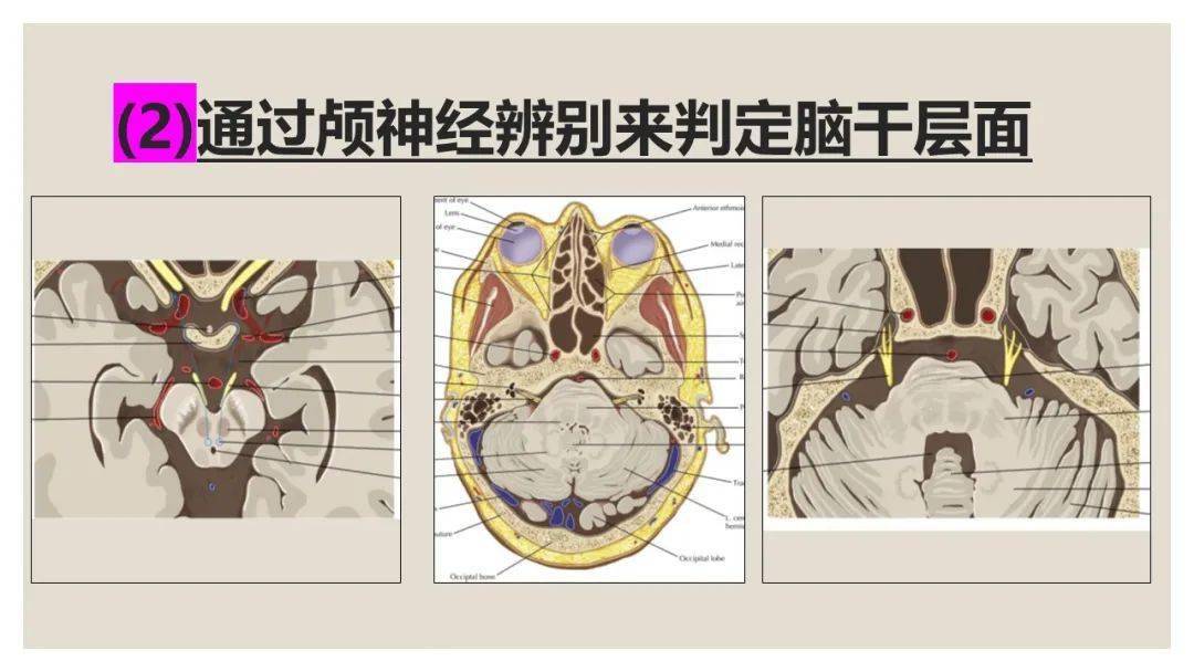 脑干精细解剖