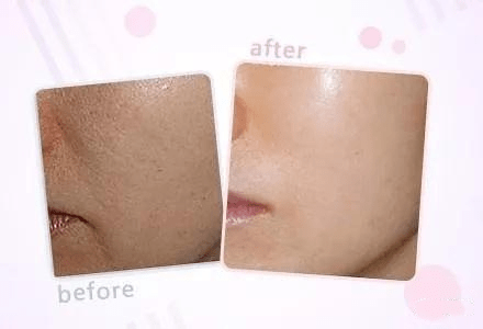 野心|钟楚曦素颜生图流出，她的野心也太大了...