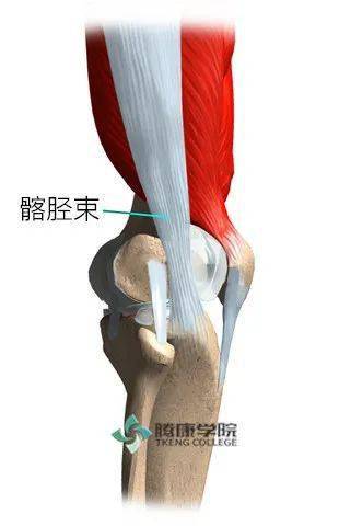 Iliotibial Band Friction (ITB) Syndrome