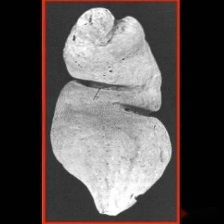 塞2斤金条藏8部手机…人类对肛门的探索太可怕了