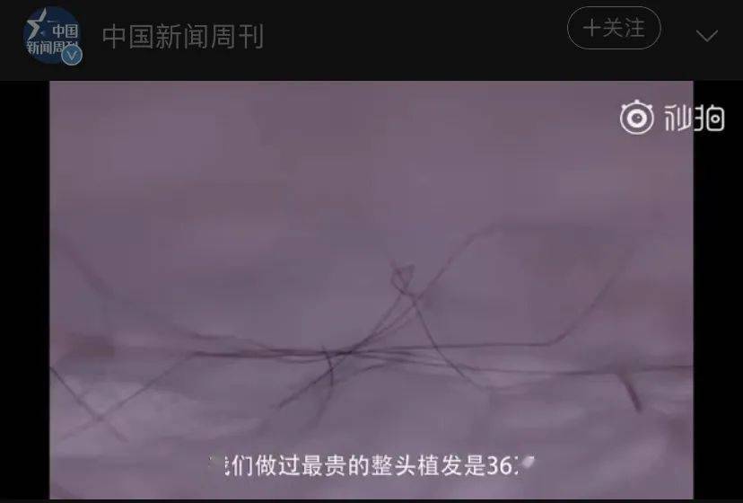 头发|这款被药剂师推荐的防脱洗发水，被张歆艺、张馨予、阿娇都争着使用！