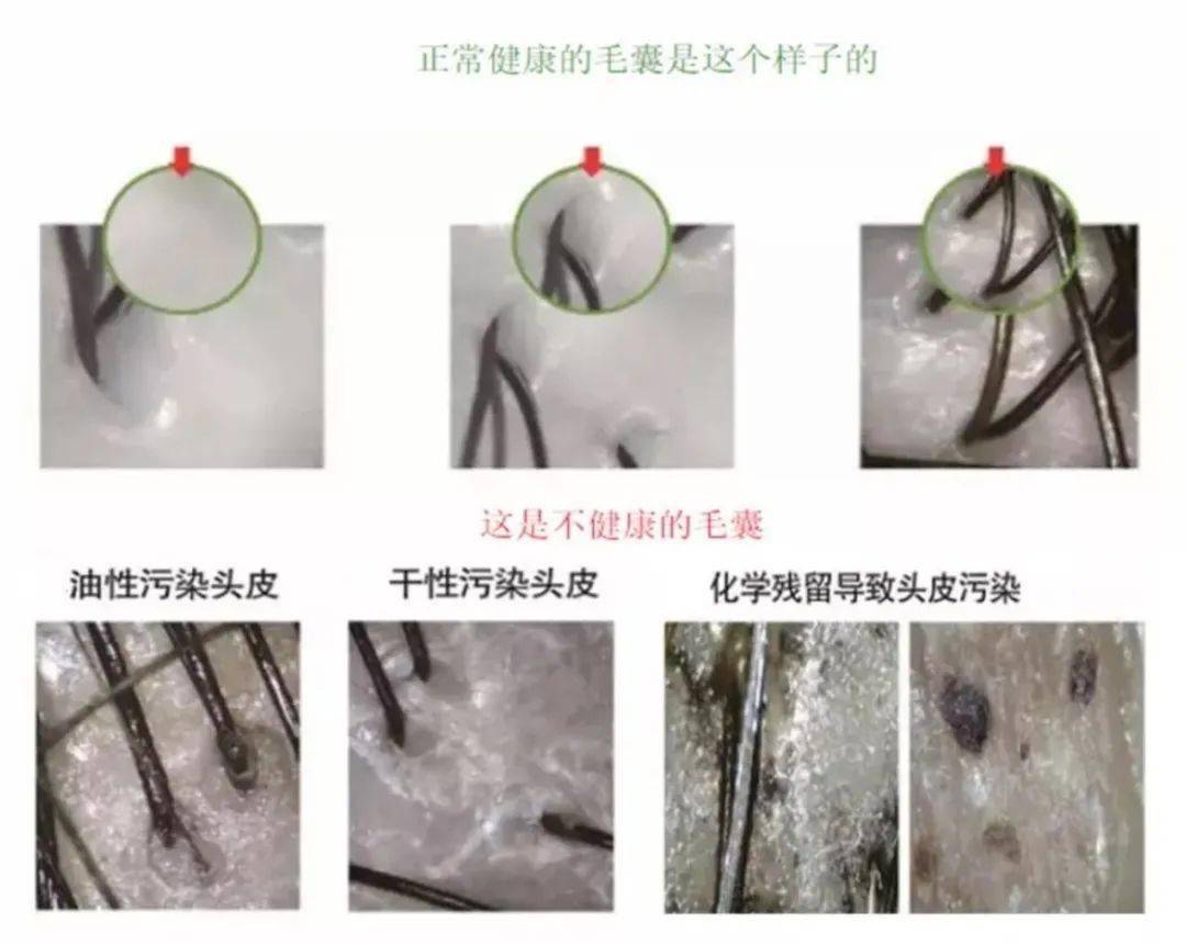 头发|这款被药剂师推荐的防脱洗发水，被张歆艺、张馨予、阿娇都争着使用！