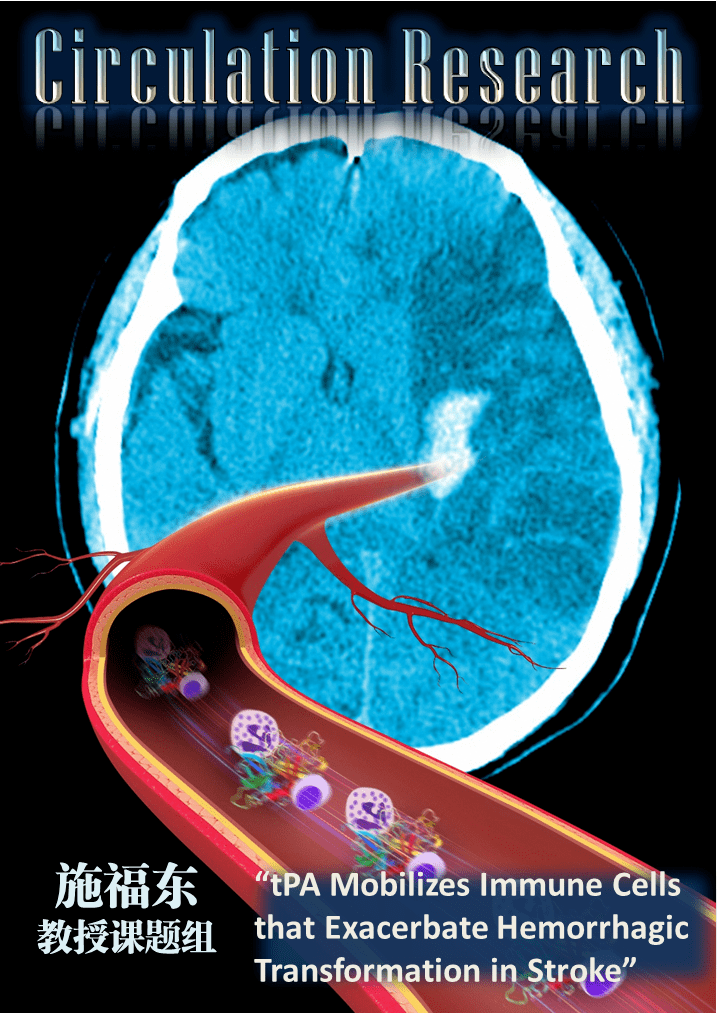 免疫|【医前沿】攻克脑卒中tPA溶栓出血转化和狭窄疗效时间窗的新希望
