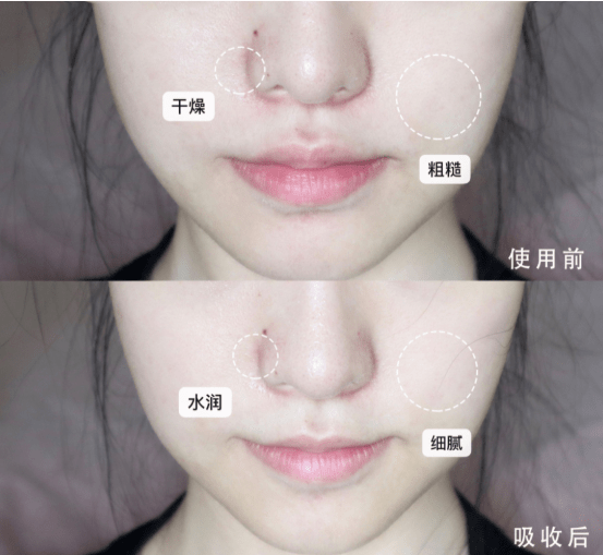 ml|5折捡漏不买后悔!科颜氏高保湿面霜限量购!秋冬敏感、干皮闭眼入!