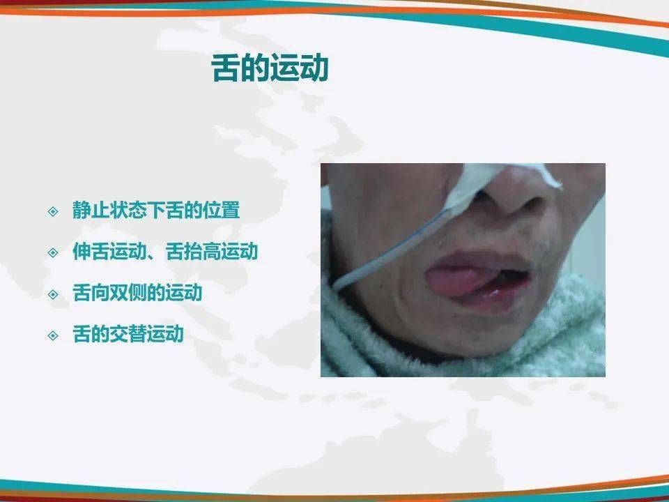 【ppt】洼田饮水试验