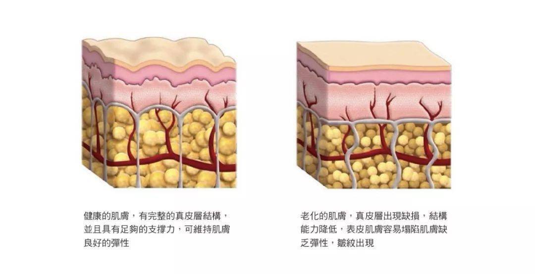 解决脸部凹陷显老,我来pick双美胶原蛋白!