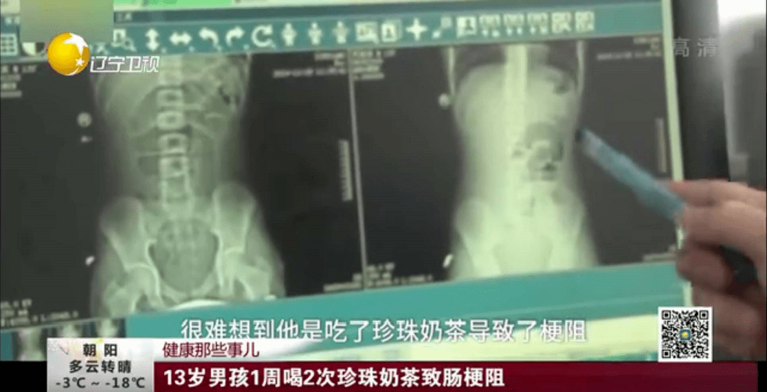 孩子|我不阻止孩子喝饮料，但这5类?被列入“黑名单”的，少给孩子喝吧！