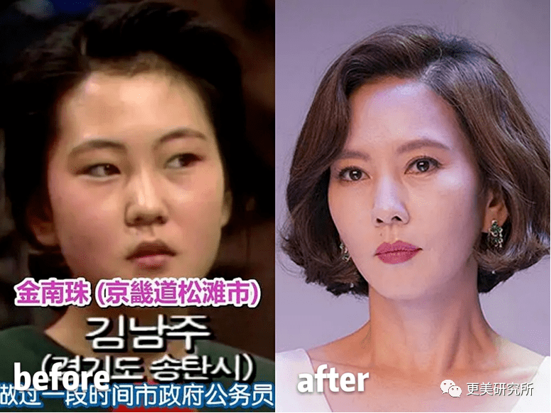 卡卡|横跨三代、100个女星同时削掉半张脸,没想到垫底的却是她...