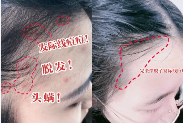 头发|洗了20几年的头，到底该洗“头皮”还是“头发”？