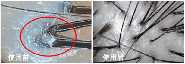 头发|洗了20几年的头，到底该洗“头皮”还是“头发”？