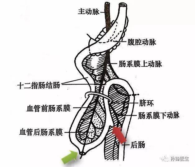什么情况下要切除胰腺 9f30ea9182c047a39e3e2ce7eec913e1.jpeg