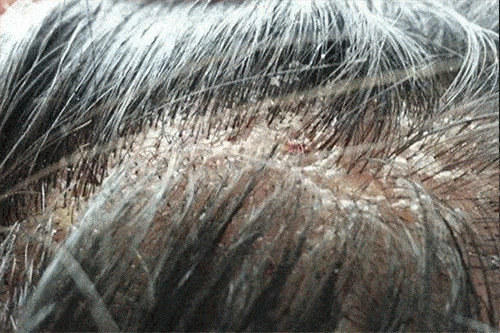 头发|洗了20几年的头，到底该洗“头皮”还是“头发”？