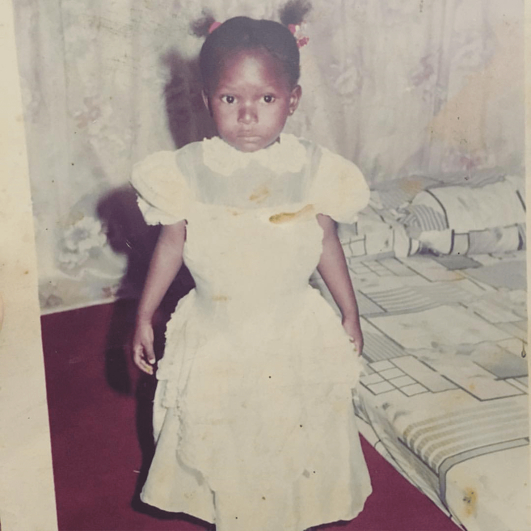 女童|非洲部落9岁毁容女童接受“换头术”，15年后现状曝光看哭网友：这才是顶级美人！