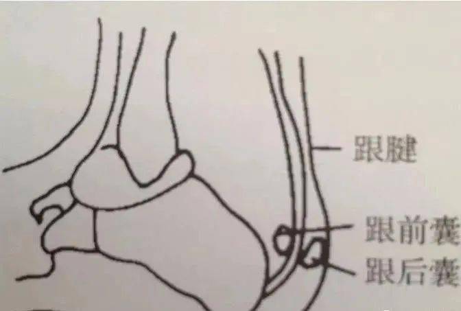 患肢伸直,医生一手虎口对着髌骨上方,手掌压在髌上囊,使液体流入关节