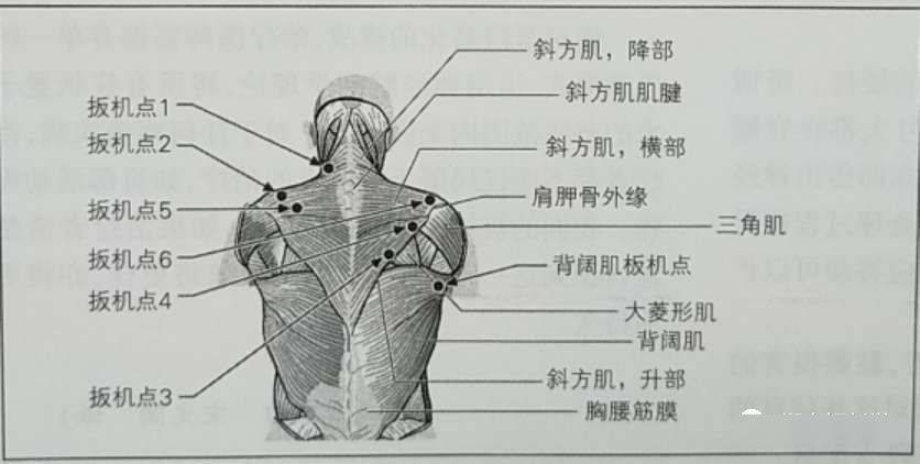 突一,斜方肌广东11月13日针刀临床应用与解剖学习班通知三叉神经痛等