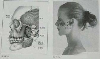 上颌骨颞下颌关节牵涉痛翼外肌的扳机点位于口内,需通过口内的触诊