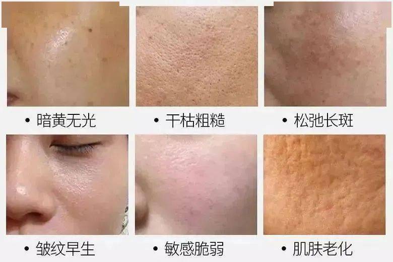 防腐剂|看得出这是40岁的年纪吗？跨越20年的逆龄秘密竟然是这？！原来吃“防腐剂”真的能长生不老？！