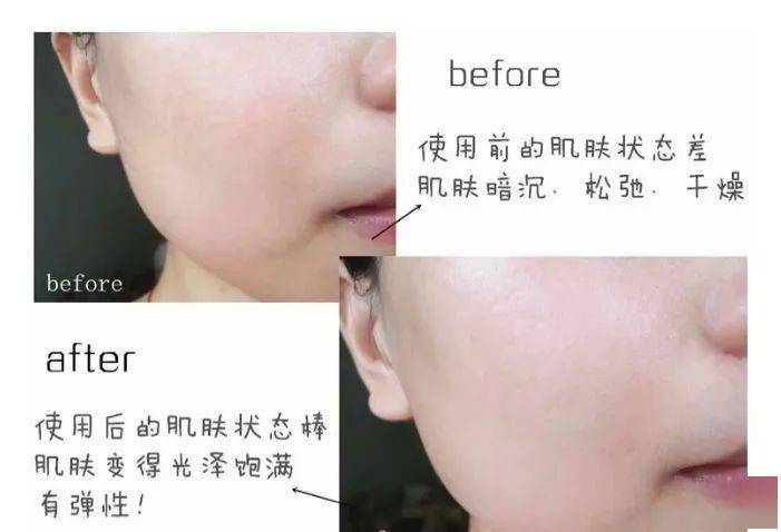 皮肤|可涂抹的“水光针”，一支8元相当于敷10片面膜，轻松抹出弹润少女肌！