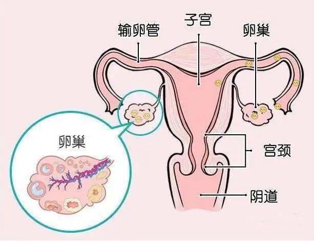 卵巢癌的常见症状