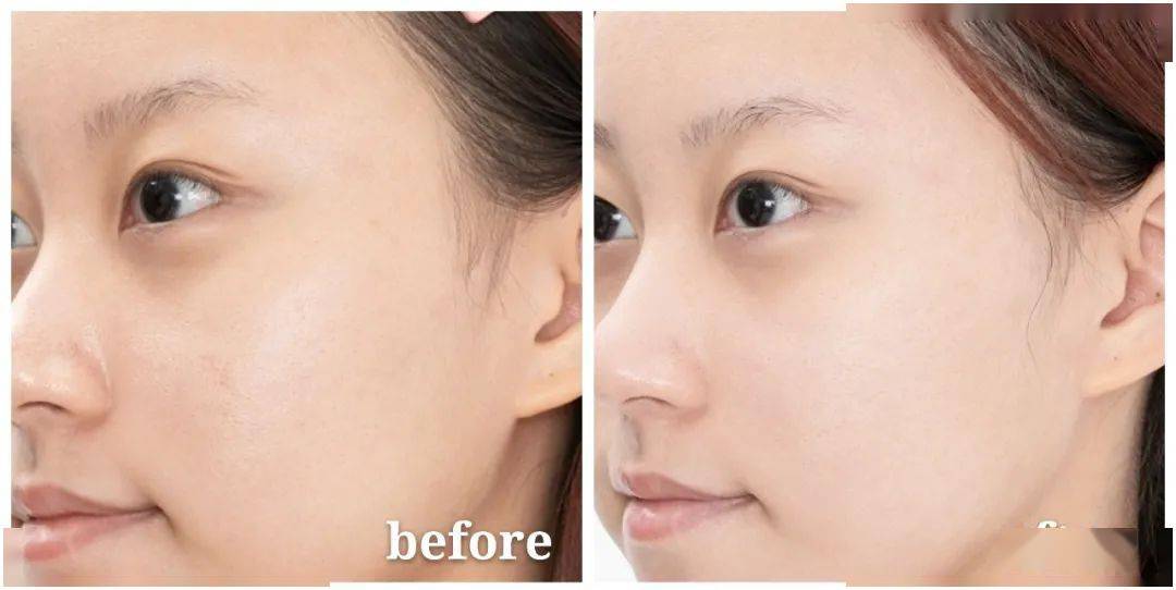 皮肤|狂吃火锅不长痘，这位影后太拉仇恨！